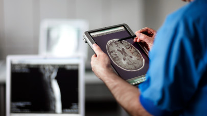 Hihetetlen magyar kutatói siker: egészen új dimenziók nyíltak a neuropszichológiában